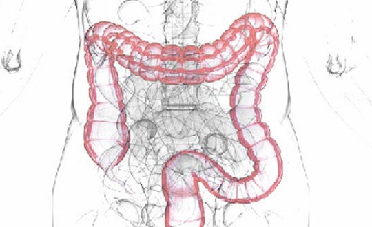 Death Begins In The Colon