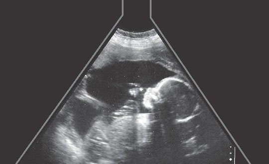 Ultrasight – A Sadhaks Experience